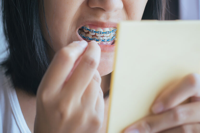 Close Up Of Woman Teeth Using Toothpick