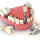 dental implants near me